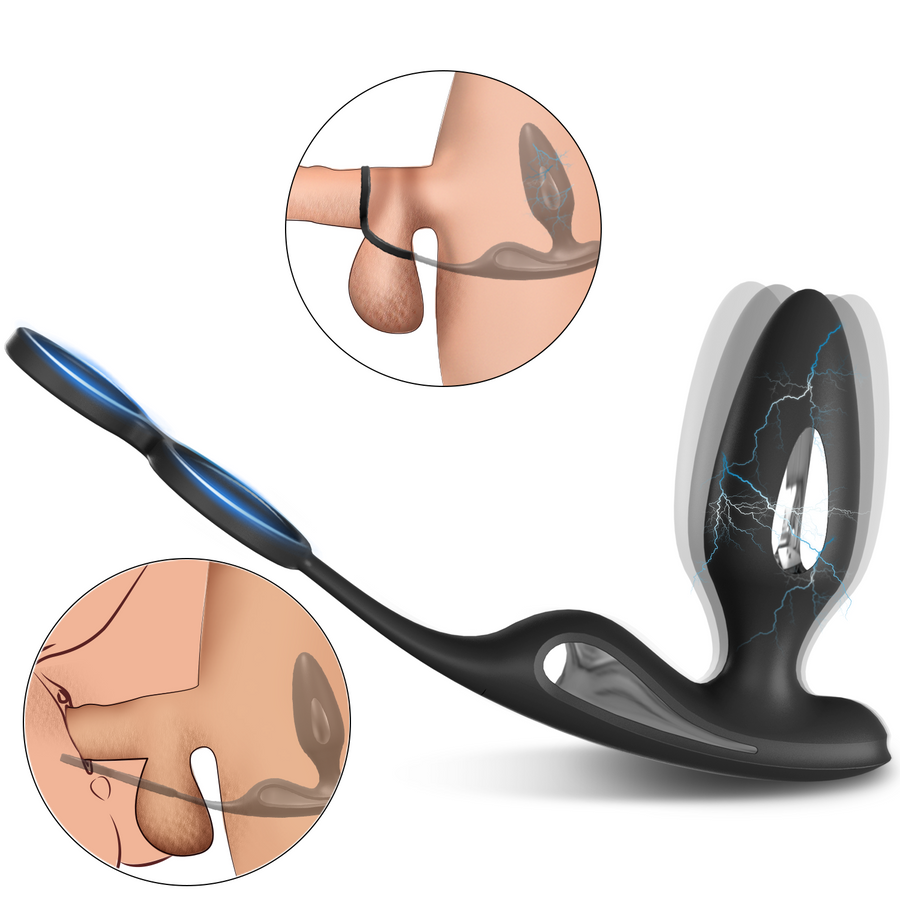 Electro Shock Prostate Plug-Black